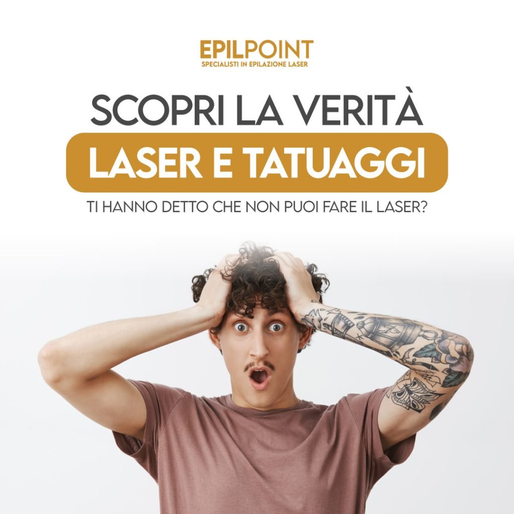 laser e tatuaggi