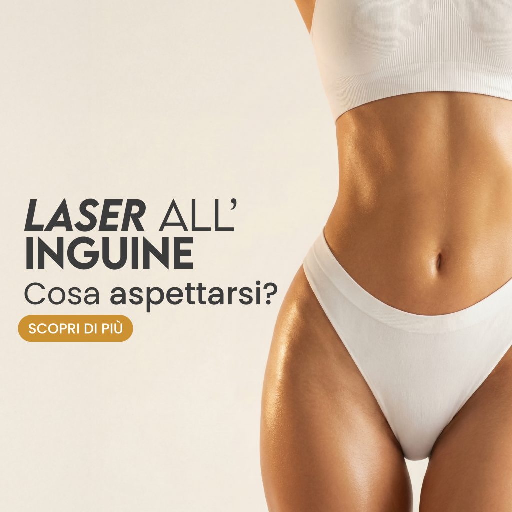 laser all'inguine