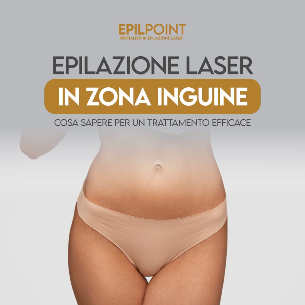 epilazione laser in zona inguine