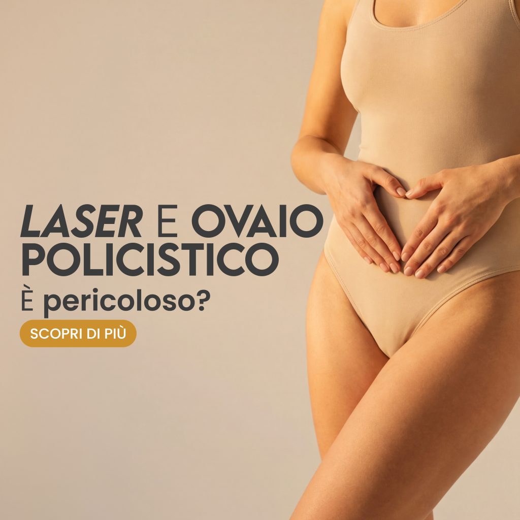 Laser e ovaio policistico