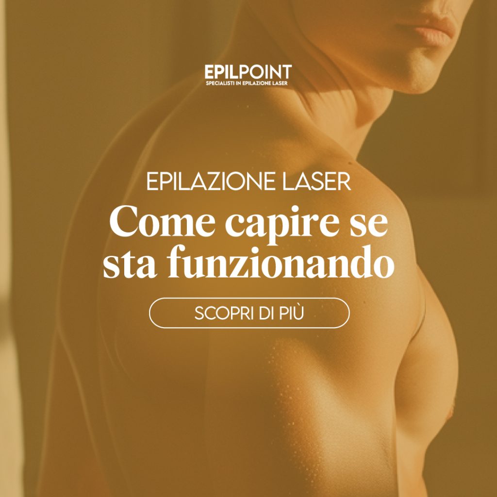 epil point epilazione laser funziona