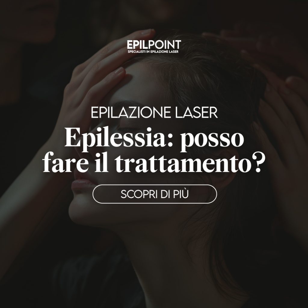 epilazione laser e epilessia