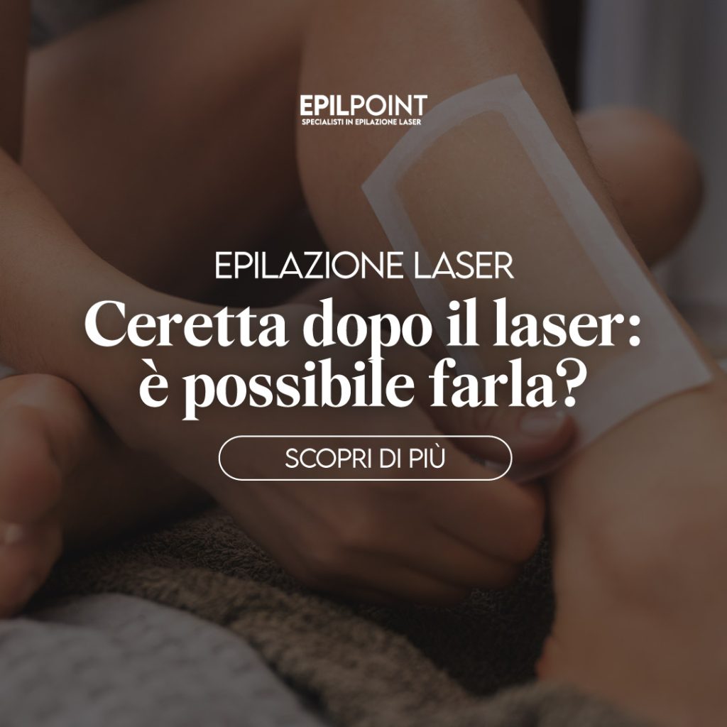 ceretta dopo il laser si può