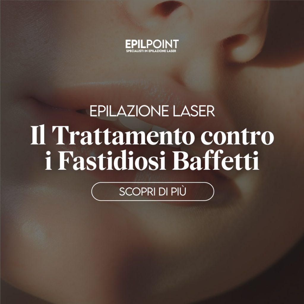 laser ai baffetti