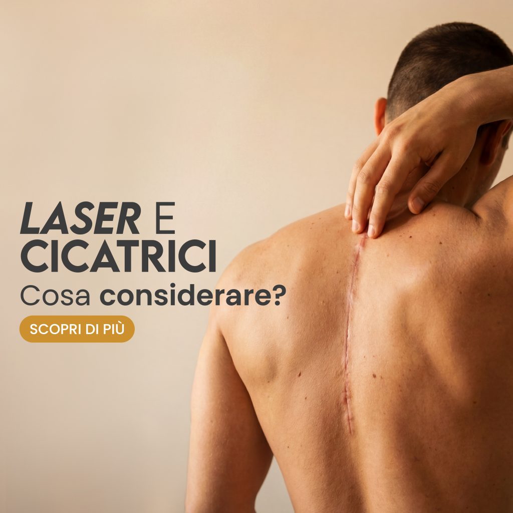 Laser e cicatrici