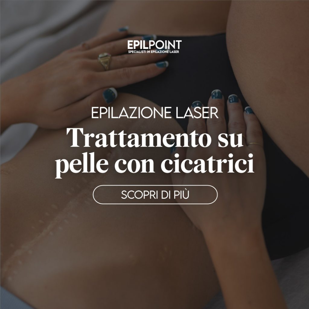 EPIL POINT epilazione laser e cicatrici