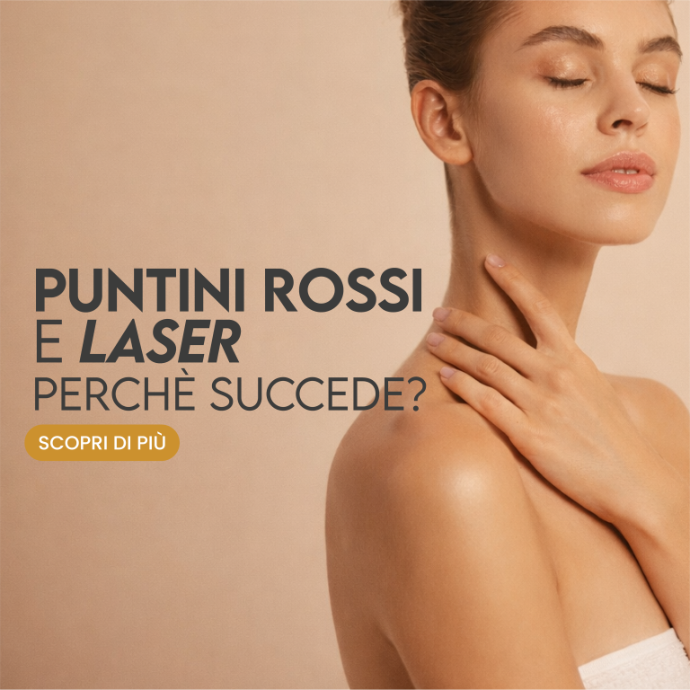 laser e puntini rossi